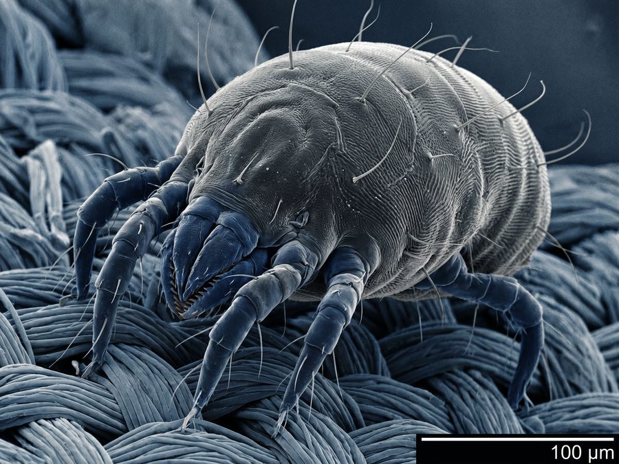 Dust mite scanning electron microscope image