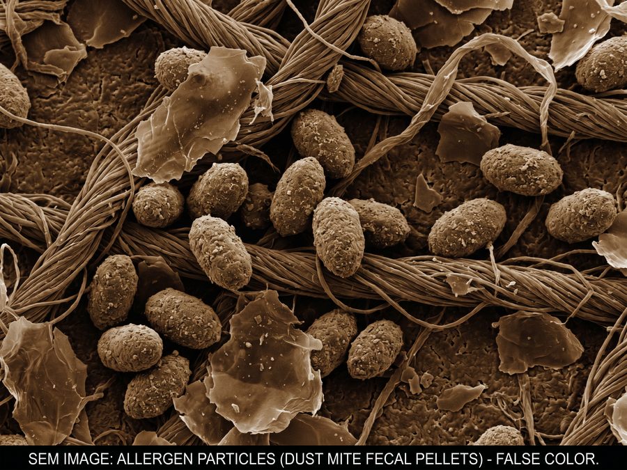 Dust mite fecal pellets under microscope
