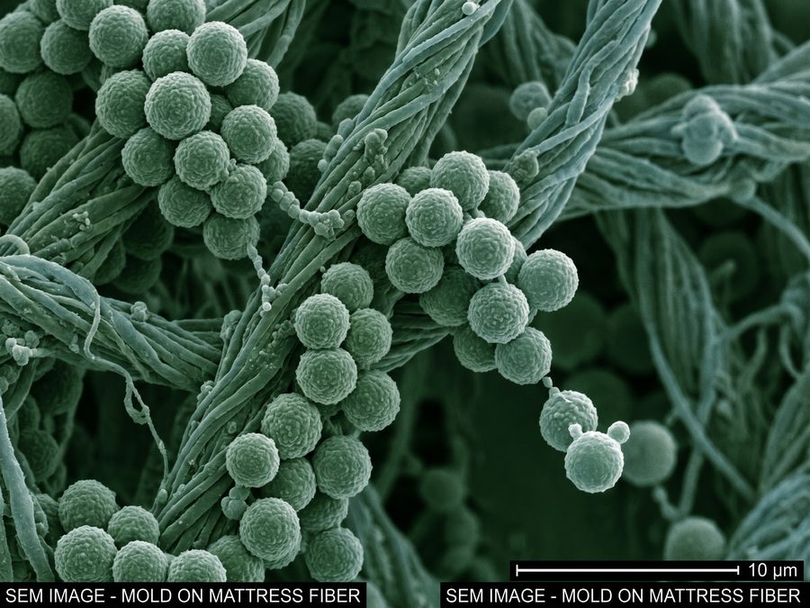 Mold spores on mattress fibers under microscope