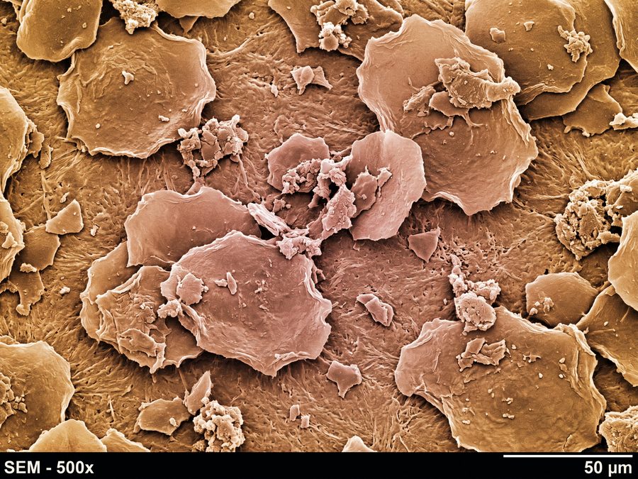 Dead skin cell flakes under microscope